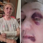 «Незнакомая женщина ударила меня кулаком в лицо, выхватила мою железную трость и начала избивать, пока не сломала… »
