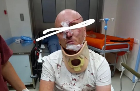 {Парни, которые издевались над бельгийцем, явились с повинной} Молдавские Ведомости