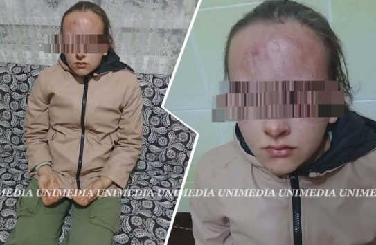 {Подростки в Яловенском районе избили и пытались утопить девочку} Молдавские Ведомости